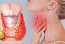 5 dấu hiệu ung thư tuyến giáp giai đoạn 1: Biết sớm sẽ kéo dài sự sống