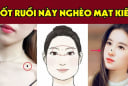 3 nốt ruồi lận đận nên tìm cách hóa giải kẻo về già cô độc