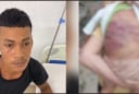 Hé lộ lời khai của cha dượng trong vụ bé trai 2 tuổi bị bạo hành đến nguy kịch