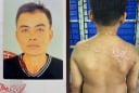 Khởi tố người cha bạo hành con ruột gây thương tích 36% gây phẫn nộ