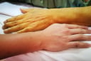5 dấu hiệu cảnh báo gan thận đang 'kêu cứu', số 1 bệnh đã chuyển nặng