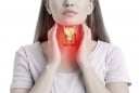 8 dấu hiệu cảnh báo ung thư tuyến giáp sớm nhất bạn không nên bỏ qua