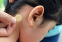 Bé gái 7 tuổi bị rối loạn hành vi, nói nhảm suốt đêm vì tác dụng phụ của miếng dán chống say tàu xe