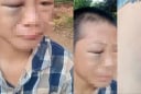 Đang xác minh vụ bé trai 12 tuổi, nghi bị bố và mẹ kế bạo hành