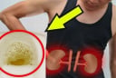 Đi tiểu thấy nhiều bọt có phải bị suy thận?
