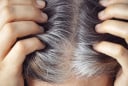 Tóc bạc sớm và rụng nhiều trước tuổi 40: Nhiều phụ nữ bắt đầu chú ý hơn đến top thực phẩm này