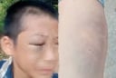 Bé trai nghi bị mẹ kế bạo hành nhiều lần: Người bố lên tiếng xin lỗi gia đình vợ cũ