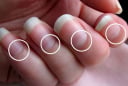 5 dấu hiệu trên móng tay chứng tỏ bạn đang mắc bệnh nan y
