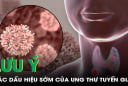 5 dấu hiệu K tuyến giáp mới chớp: Biết sớm chữa là khỏi