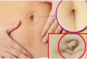 Nhìn tướng rốn 3 giây biết tương lai bạn giàu sang hay nghèo khổ