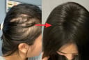 Lời khuyên dành phụ nữ có tóc rụng nhiều, mọc chậm, tóc càng ngày càng mỏng