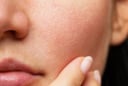 Ngồi điều hòa nhiều khiến da khô ráp? Thử ngay phương pháp dưỡng da “nhiều lớp” để giữ da căng mịn