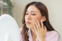 3 sai lầm chăm sóc da nhiều người mắc phải vào mùa hè khiến da đổ dầu, nổi mụn và nhanh lão hóa