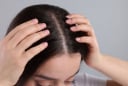 Nguyên nhân gội đầu xong vẫn nhiều gàu và ngứa