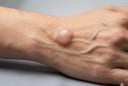 Cảnh báo: 4 thay đổi bất thường ở cánh tay có thể là 'tín hiệu cầu cứu' của cơ thể trước bệnh ung thư
