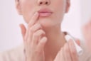 Môi khô, nứt nẻ kéo dài: Cách chăm sóc giúp đôi môi luôn mềm mại