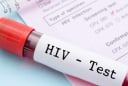 Dấu hiệu HIV trên cơ thể: Những biểu hiện âm thầm dễ bị bỏ qua