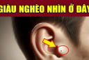 3 nốt ruồi hao tài lận đận tình duyên