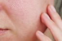 Lỗ chân lông trông nhỏ hơn nhờ quy trình chăm sóc da chỉ với 4 bước cơ bản