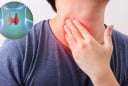 5 dấu hiệu u tuyến giáp đang âm thầm phát triển, nhiều người bỏ qua
