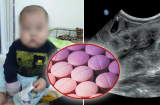 Cảnh báo từ vụ: Bé trai 17 tháng tuổi ở Tuyên Quang bị suy thượng thận cấp do dùng sai thuốc ho
