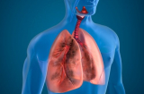 4 cách làm SẠCH BÁCH cặn bã trong phổi, phòng tránh mầm mống ung thư cực kì hiệu quả