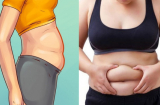 3 kiểu béo bụng không phải do tăng cân mà là lời 'ngầm báo' căn bệnh rất dễ mắc phải