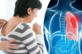 5 dấu hiệu cảnh báo phổi đang bị tấn công, thường bị nhiều người bỏ qua mà không biết