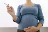 Những thói quen tai hại mẹ vẫn làm khi mang thai khiến bé sinh ra dễ mang vết bớt trên người