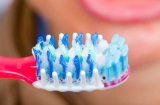 Cảnh báo: Lười đánh răng có thể gây nguy cơ mắc bệnh ung thư!