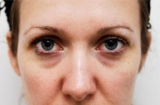 Muốn biết tử cung khỏe hay yếu, phụ nữ nhìn vào 4 điểm này trên khuôn mặt sẽ rõ