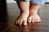 Những lợi ích bất ngờ của việc cho con đi chân trần, cha mẹ nên biết