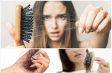 7 nguyên nhân chính gây rụng tóc, coi chừng bệnh lý tiềm ẩn