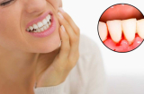 5 biểu hiện vào buổi sáng ngầm cảnh báo gan có vấn đề, số 2 nhiều người nhầm tưởng bệnh răng miệng
