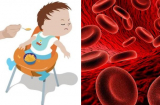 Trẻ thiếu máu rất nguy hiểm, nếu thấy con có 5 biểu hiện này cha mẹ không được chủ quan