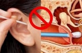 ‘Vạch trần’ 5 nguyên nhân gây ngứa lỗ tai, số 2 rất nhiều người mắc phải