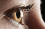 6 điều mắt đang cố gắng 'cảnh báo' với bạn về sức khỏe, đừng bỏ qua