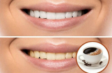 8 bí kíp giúp răng luôn trắng sáng dù uống cà phê mỗi ngày