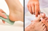 Mùa hè chân dễ ra mồ hôi và bốc mùi khó chịu: Muốn chân sạch sẽ cứ áp dụng cách này