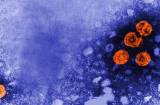 Xuất hiện virus bí ẩn gây viêm gan cho trẻ em ở nhiều nước