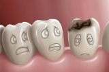 5 thói quen ăn uống sai cách làm phá huỷ răng của trẻ