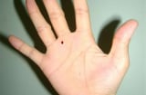 Sở hữu 5 nốt ruồi này ở bàn tay chứng tỏ bạn là 'con cưng' của Thần Tài, tiền tiêu cả đời không hết