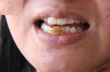 Vì sao người xưa luôn dùng răng để thử vàng? Lý do quá thông minh