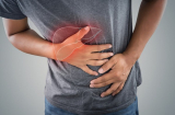 4 vùng cơ thể đau nhói chứng tỏ bệnh gan đã đi vào giai đoạn nặng, khám chữa ngay còn kịp