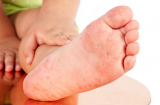 Lòng bàn chân có 4 dấu hiệu này chứng tỏ chức năng gan của bạn đang suy giảm, ai không có thật đáng mừng
