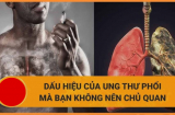 5 thói quen mở đường cho K tấn công, cái số 3 nhiều người mắc phải