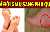 5 nốt ruồi quý hơn vàng, ai có 1/5 cái số giàu sang hết nấc