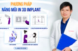 Bác sĩ Nguyễn Tuấn Anh cùng ứng dụng công nghệ Nâng Mũi In 3D Implant