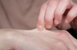 5 giây kiểm tra mức độ lão hóa: Da bao nhiêu tuổi biết ngay