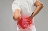 Thận yếu là gì? Cách nhận biết thận khỏe hay yếu không nên bỏ qua